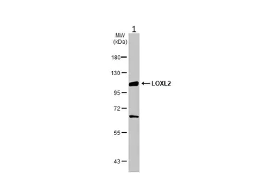 Western blot - Anti-LOXL2 antibody (AB96233)