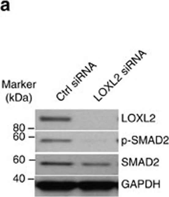 Western blot - Anti-LOXL2 antibody (AB96233)