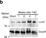 Western blot - Anti-LOXL2 antibody (AB96233)