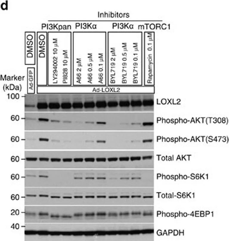 Western blot - Anti-LOXL2 antibody (AB96233)