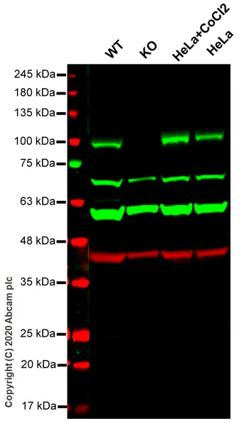 Western blot - Anti-LOXL2 antibody [EPR12733] - BSA and Azide free (AB213598)