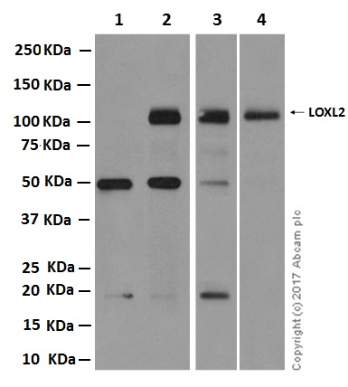 Western blot - Anti-LOXL2 antibody [EPR12733] - C-terminal (AB179810)
