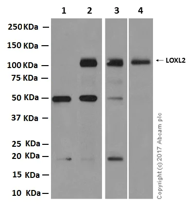 Western blot - Anti-LOXL2 antibody [EPR12733] - C-terminal (AB179810)