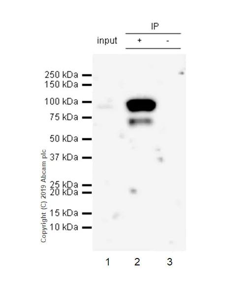 Immunoprecipitation - Anti-LOXL2 antibody [EPR23035-105] (AB260046)