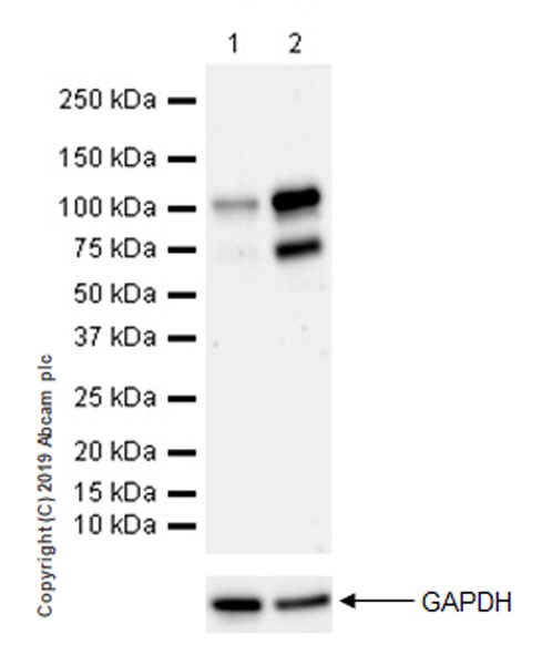 Western blot - Anti-LOXL2 antibody [EPR23035-105] (AB260046), expandable thumbnail