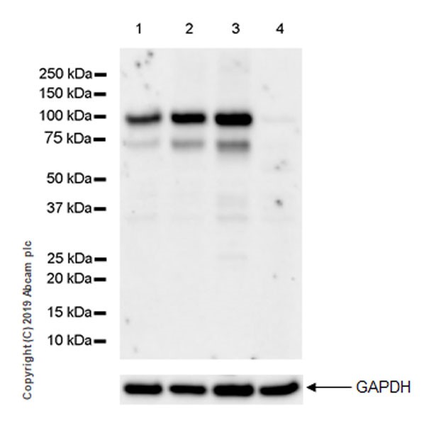 Western blot - Anti-LOXL2 antibody [EPR23035-105] (AB260046), expandable thumbnail