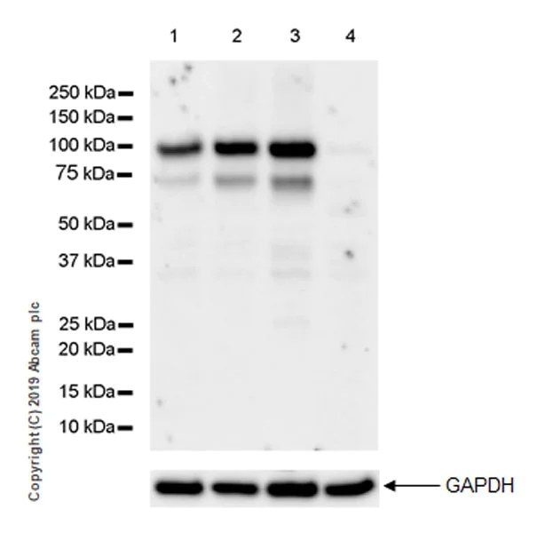 Western blot - Anti-LOXL2 antibody [EPR23035-105] (AB260046)