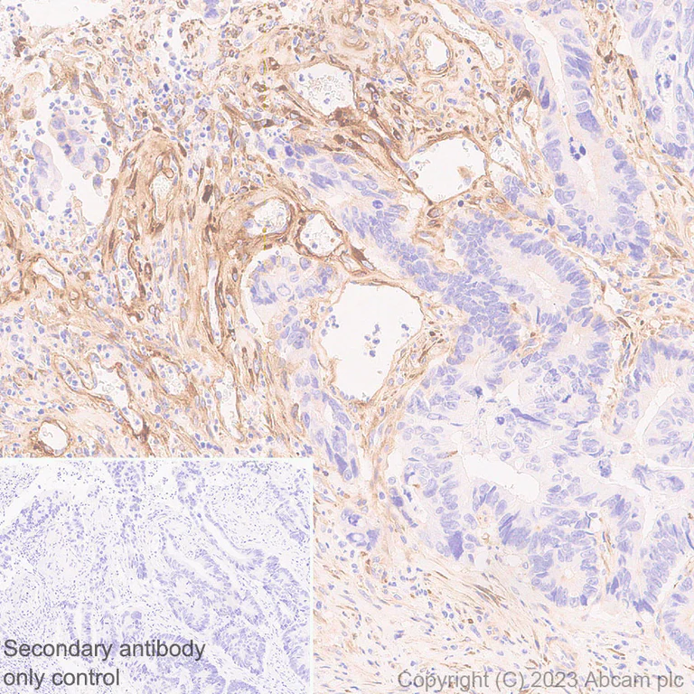 Immunohistochemistry (Formalin/PFA-fixed paraffin-embedded sections) - Anti-LOXL2 antibody [EPR28298-7] (AB314140)