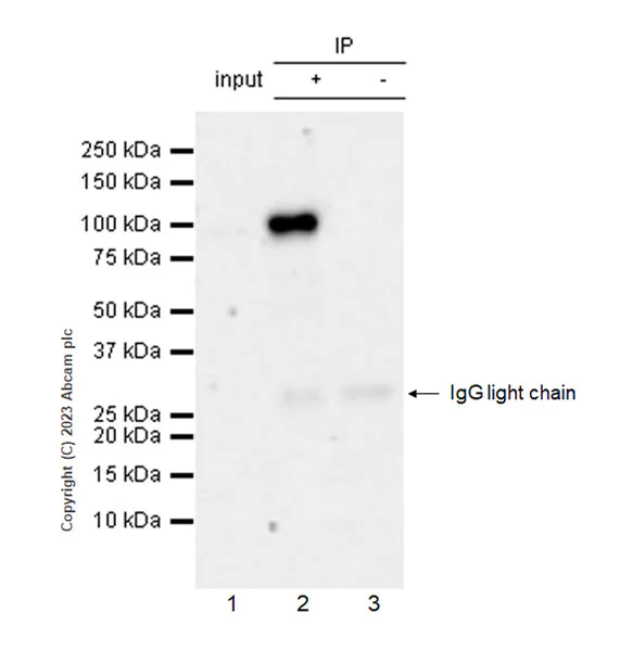 Immunoprecipitation - Anti-LOXL2 antibody [EPR28298-7] (AB314140)