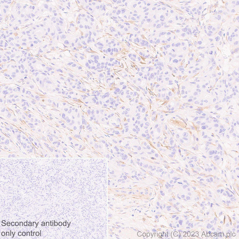 Immunohistochemistry (Formalin/PFA-fixed paraffin-embedded sections) - Anti-LOXL2 antibody [EPR28298-7] - BSA and Azide free (AB314141)