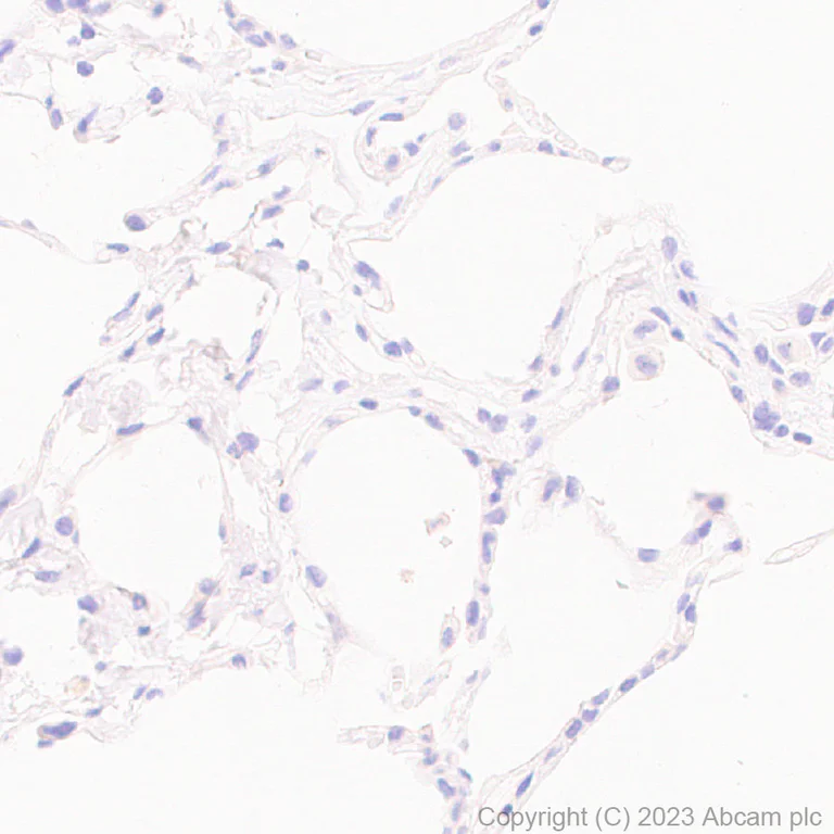Immunohistochemistry (Formalin/PFA-fixed paraffin-embedded sections) - Anti-LOXL2 antibody [EPR28298-7] - BSA and Azide free (AB314141)