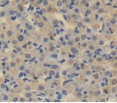 Immunohistochemistry (Formalin/PFA-fixed paraffin-embedded sections) - Anti-LOXL3 antibody (AB232878), expandable thumbnail