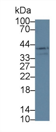 Western blot - Anti-LOXL3 antibody (AB232878), expandable thumbnail