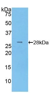 Western blot - Anti-LOXL3 antibody (AB232878)