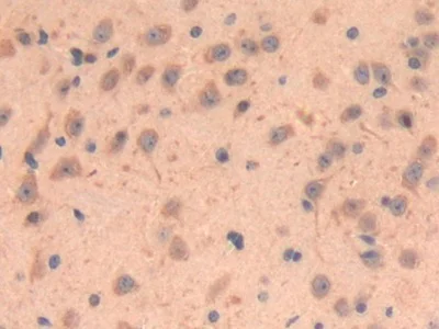 Immunohistochemistry (Formalin/PFA-fixed paraffin-embedded sections) - Anti-LOXL3 antibody (AB232884)