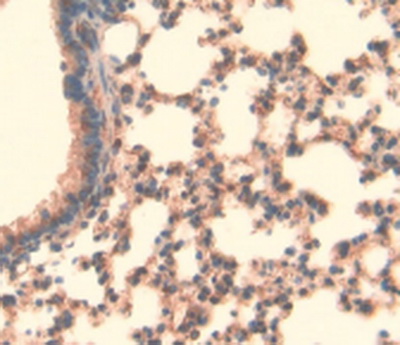 Immunohistochemistry (Formalin/PFA-fixed paraffin-embedded sections) - Anti-LOXL3 antibody (AB232884)