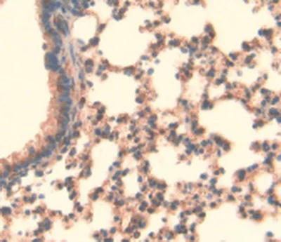 Immunohistochemistry (Formalin/PFA-fixed paraffin-embedded sections) - Anti-LOXL3 antibody (AB232884)
