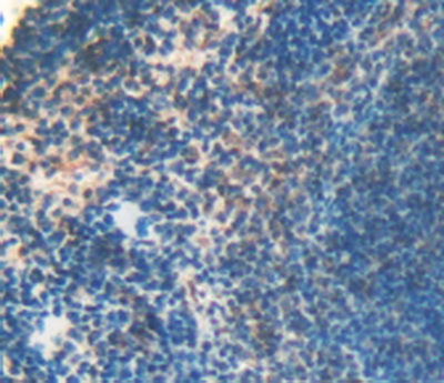 Immunohistochemistry (Formalin/PFA-fixed paraffin-embedded sections) - Anti-LOXL3 antibody (AB232884)