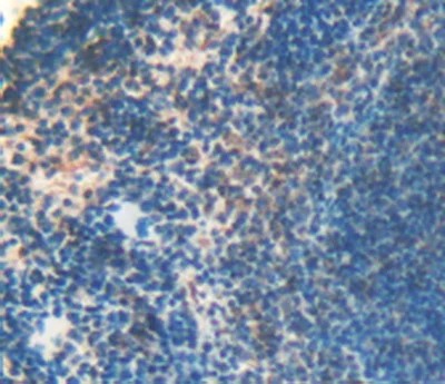 Immunohistochemistry (Formalin/PFA-fixed paraffin-embedded sections) - Anti-LOXL3 antibody (AB232884)