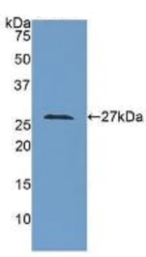 Western blot - Anti-LOXL3 antibody (AB232884)