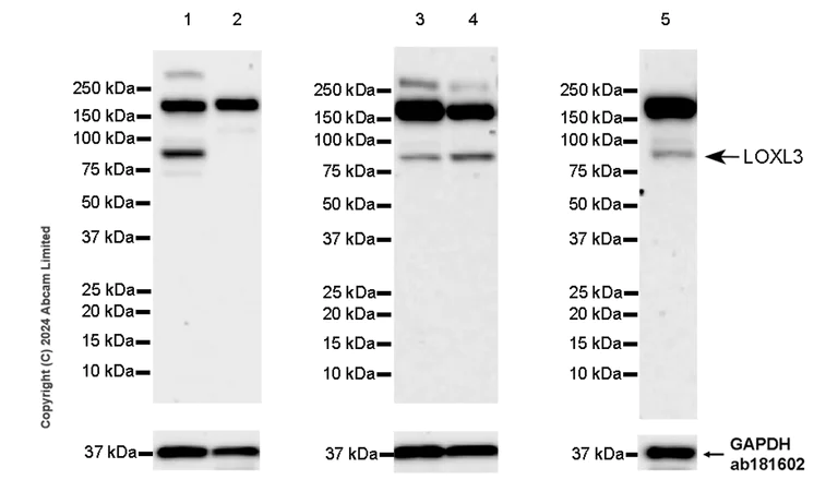 Western blot - Anti-LOXL3 antibody [EPR28299-24] (AB319041)