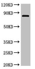 Western blot - Anti-LOXL4 antibody (AB229716), expandable thumbnail