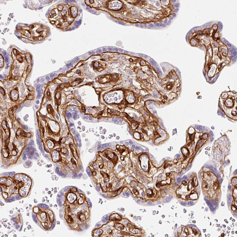 Immunohistochemistry (Formalin/PFA-fixed paraffin-embedded sections) - Anti-LOXL4 antibody (AB262890)