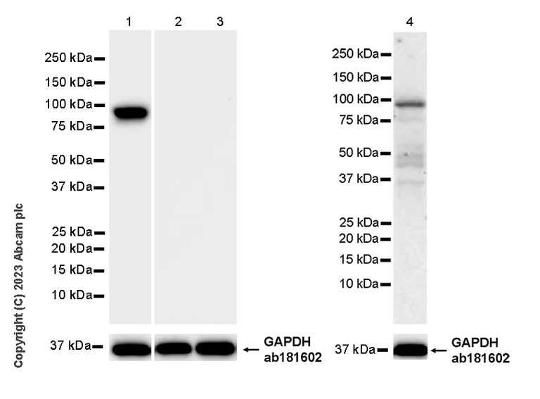 Western blot - Anti-LOXL4 antibody [EPR28300-90] (AB313797)