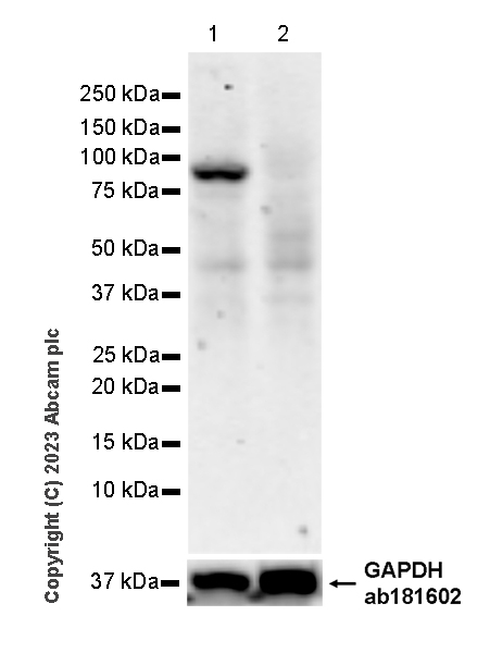 Western blot - Anti-LOXL4 antibody [EPR28300-90] (AB313797), expandable thumbnail