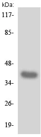 Western blot - Anti-LPA-2 antibody (AB135980)