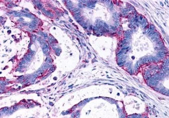 Immunohistochemistry (Formalin/PFA-fixed paraffin-embedded sections) - Anti-LPA-3 antibody (AB219267)