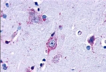 Immunohistochemistry (Formalin/PFA-fixed paraffin-embedded sections) - Anti-LPA-3 antibody (AB219267)