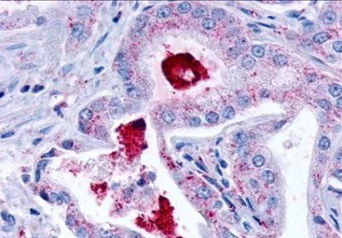 Immunohistochemistry (Formalin/PFA-fixed paraffin-embedded sections) - Anti-LPA-3 antibody (AB219267)