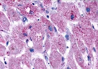 Immunohistochemistry (Formalin/PFA-fixed paraffin-embedded sections) - Anti-LPA-3 antibody (AB219267)