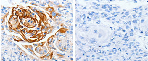 Immunohistochemistry (Formalin/PFA-fixed paraffin-embedded sections) - Anti-LPA-4 antibody (AB183076)