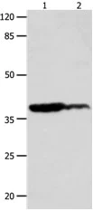 Western blot - Anti-LPA-4 antibody (AB183076)