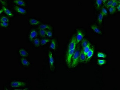 Immunocytochemistry/ Immunofluorescence - Anti-LPA-4 antibody (AB236731), expandable thumbnail