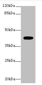 Western blot - Anti-LPA-4 antibody (AB236731), expandable thumbnail