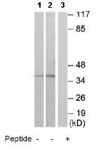 Western blot - Anti-LPA-5 antibody (AB77680)