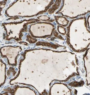 Immunohistochemistry (Formalin/PFA-fixed paraffin-embedded sections) - Anti-LPCAT-2 antibody (AB224244)