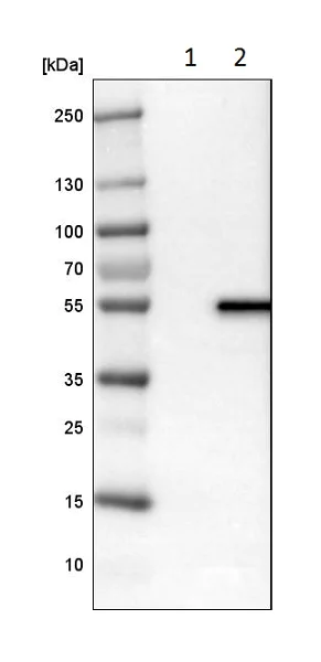 Western blot - Anti-LPCAT-2 antibody (AB224244)