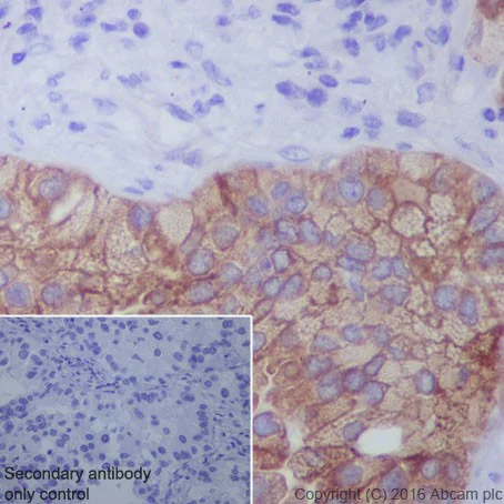 Immunohistochemistry (Formalin/PFA-fixed paraffin-embedded sections) - Anti-LPCAT1 antibody [EPR19882] - BSA and Azide free (AB251545)