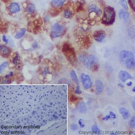 Immunohistochemistry (Formalin/PFA-fixed paraffin-embedded sections) - Anti-LPCAT1 antibody [EPR19882] - BSA and Azide free (AB251545)