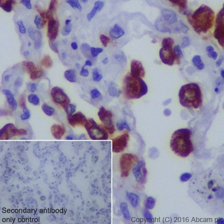 Immunohistochemistry (Formalin/PFA-fixed paraffin-embedded sections) - Anti-LPCAT1 antibody [EPR19882] - BSA and Azide free (AB251545), expandable thumbnail