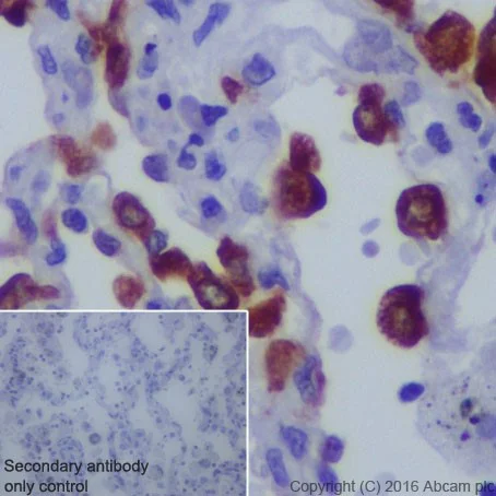 Immunohistochemistry (Formalin/PFA-fixed paraffin-embedded sections) - Anti-LPCAT1 antibody [EPR19882] - BSA and Azide free (AB251545)