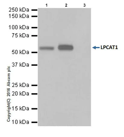 Immunoprecipitation - Anti-LPCAT1 antibody [EPR19882] - BSA and Azide free (AB251545)
