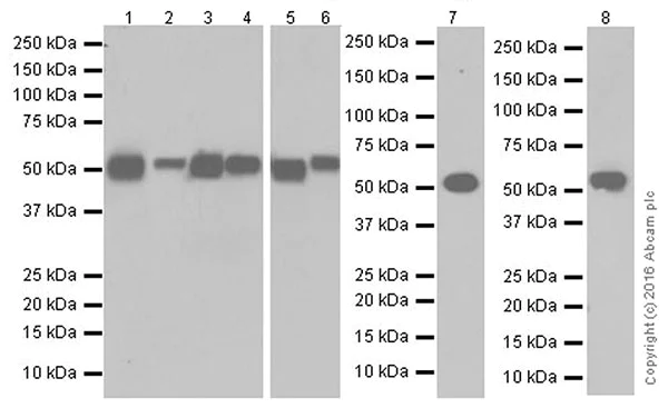 Western blot - Anti-LPCAT1 antibody [EPR19882] - BSA and Azide free (AB251545)