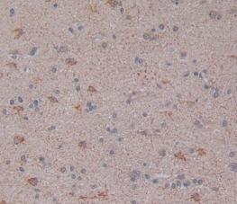 Immunohistochemistry (Formalin/PFA-fixed paraffin-embedded sections) - Anti-LPCAT3 antibody [6-2#] (AB239585)