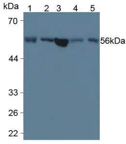 Western blot - Anti-LPCAT3 antibody [6-2#] (AB239585)