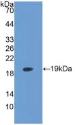 Western blot - Anti-LPCAT3 antibody [6-2#] (AB239585)